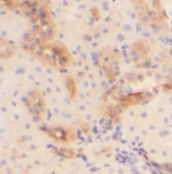 ADM Rabbit Polyclonal Antibody