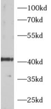 ADRM1 Rabbit Polyclonal Antibody