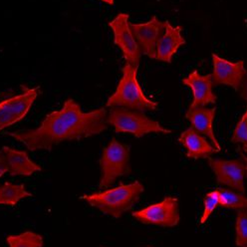 ADSS2 Rabbit Polyclonal Antibody