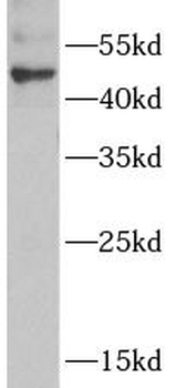 ADSS2 Rabbit Polyclonal Antibody