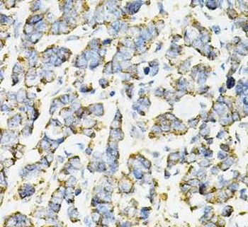 ADSS2 Rabbit Polyclonal Antibody