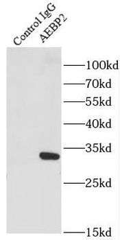 AEBP2 Rabbit Polyclonal Antibody