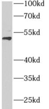 AEBP2 Rabbit Polyclonal Antibody