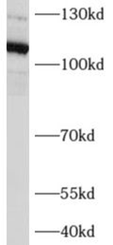 AFAP1L2 Antibody