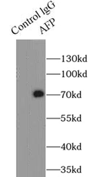 AFP Antibody