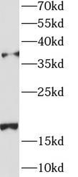 AGA Rabbit Polyclonal Antibody