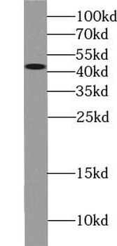 AGER Rabbit Polyclonal Antibody
