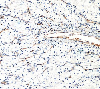AGER Rabbit Polyclonal Antibody