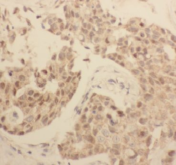 AGFG1 Rabbit Polyclonal Antibody