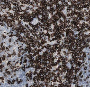 AGFG2 Rabbit Polyclonal Antibody
