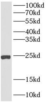 AGR3 Rabbit Polyclonal Antibody