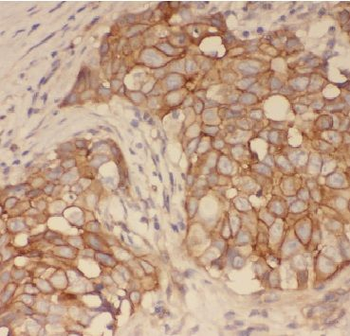 AGR3 Rabbit Polyclonal Antibody