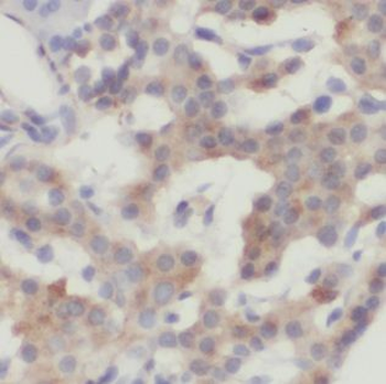 PHYKPL Rabbit Polyclonal Antibody