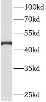 AHCY Rabbit Polyclonal Antibody