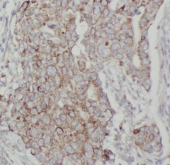 AHCY Rabbit Polyclonal Antibody