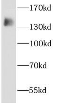 AHI1 Rabbit Polyclonal Antibody