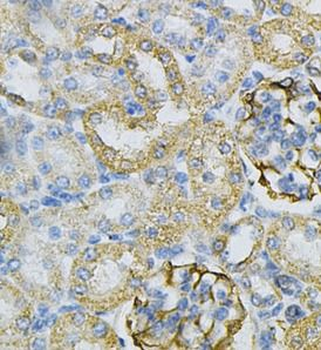 AK1 Antibody