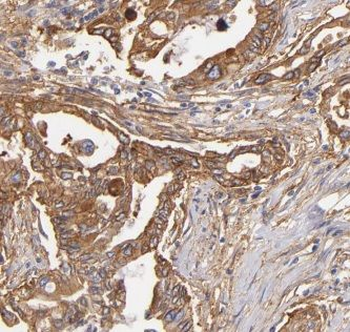 AK3 Rabbit Polyclonal Antibody