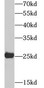 AK4 Rabbit Polyclonal Antibody