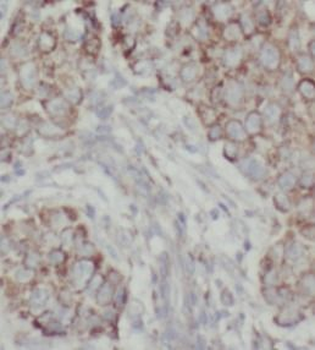 AK4 Rabbit Polyclonal Antibody