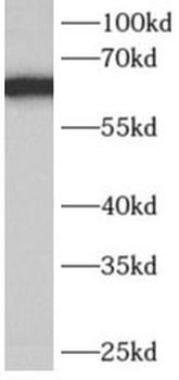 AK5 Rabbit Polyclonal Antibody