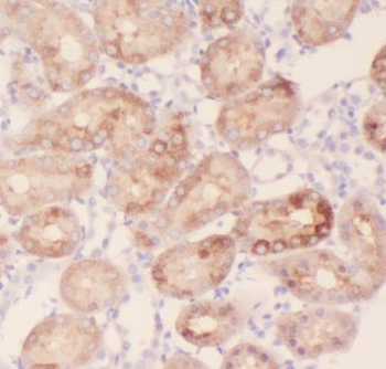 AKAP14 Rabbit Polyclonal Antibody