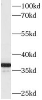 AKR1C4 Rabbit Polyclonal Antibody