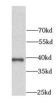 AKR7A2 Antibody
