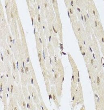 AAAS Rabbit Polyclonal Antibody