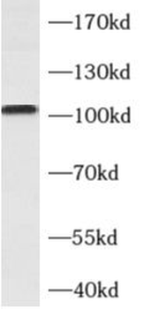 ALCAM Antibody