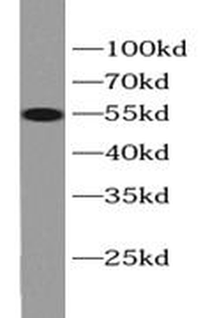 ALDH1A1 Antibody