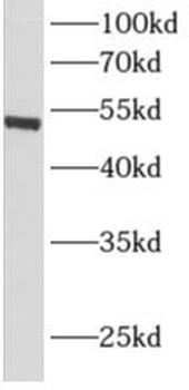 ALDH1A1 Rabbit Polyclonal Antibody