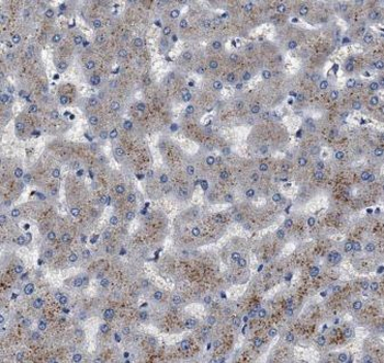 ALDH1A1 Rabbit Polyclonal Antibody