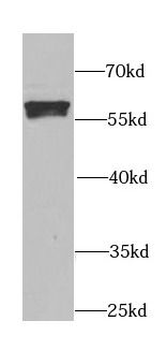 ALDH1A2 Rabbit Polyclonal Antibody