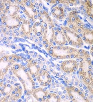 ALDH1A2 Rabbit Polyclonal Antibody