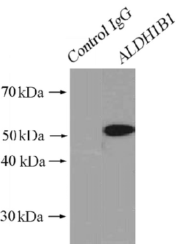 ALDH1B1 Antibody