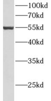 ALDH3A2 Rabbit Polyclonal Antibody