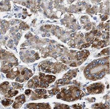 ALDH3A2 Rabbit Polyclonal Antibody