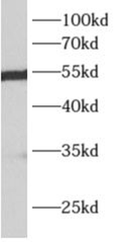 ALDH7A1 Rabbit Polyclonal Antibody