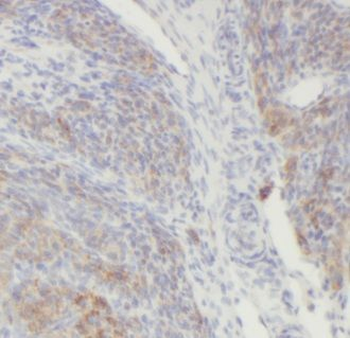 ALDH7A1 Rabbit Polyclonal Antibody