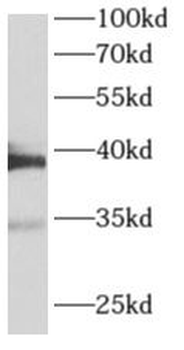 ALDOA Rabbit Polyclonal Antibody