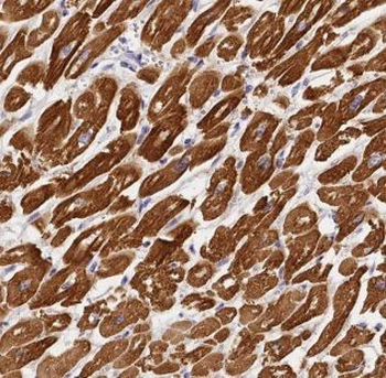 ALDOA Rabbit Polyclonal Antibody