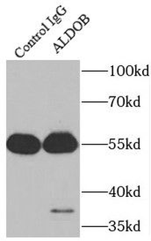 ALDOB Rabbit Polyclonal Antibody