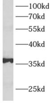 ALDOB Rabbit Polyclonal Antibody