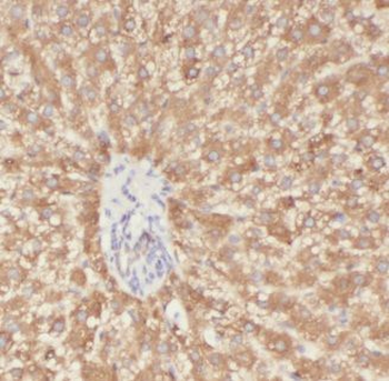 ALDOB Rabbit Polyclonal Antibody