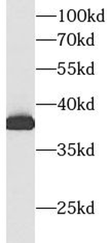 ALDOC Mouse Monoclonal Antibody