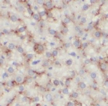 ALDOC Mouse Monoclonal Antibody