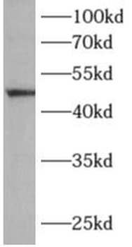 ALG1 Rabbit Polyclonal Antibody
