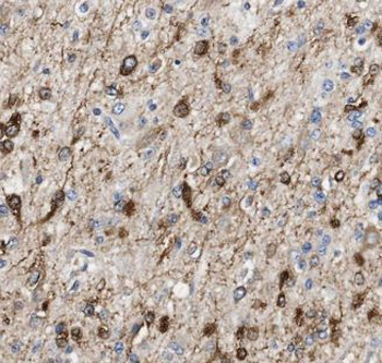 ALG1 Rabbit Polyclonal Antibody