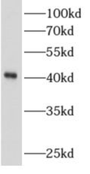 ALKBH1 Rabbit Polyclonal Antibody